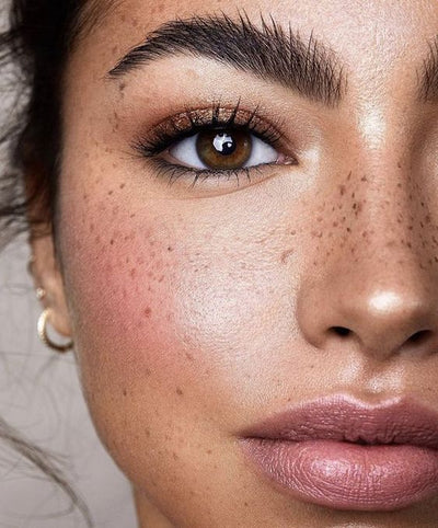 Patchs taches de rousseur x6 - NINA PERFECT SKIN
